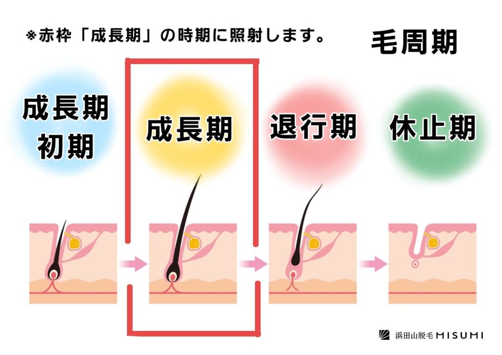 １回の施術でツルツルになる 施術完了までの回数と期間のお話 浜田山脱毛misumi